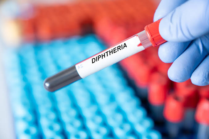 Diphtérie